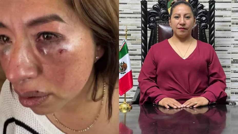 Capulhuac en crisis; exhiben agresión violenta de la alcaldesa